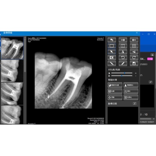  X-ray machine+Eco sensor large size