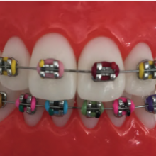 Orthodontic elastic