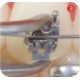 OT series self ligating bracket