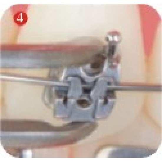 OT series self ligating bracket